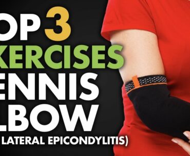 Top 3 Exercises for Tennis Elbow (aka Lateral Epicondylitis)