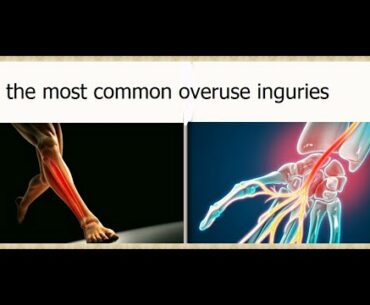 THE MOST COMMON OVERUSE INJURIES