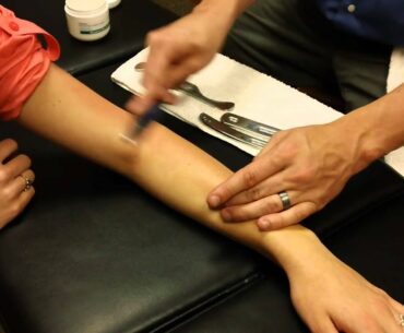 Graston Technique Treatment for Tennis Elbow - Sports Medicine Doctor in Bozeman, MT