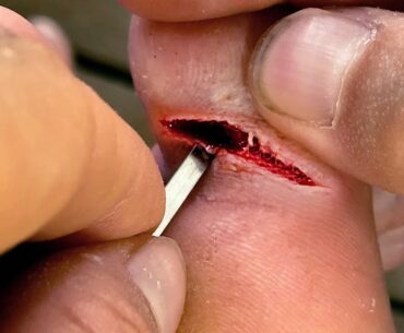 Why You SHOULD Wear Shoes Fishing!