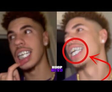 LaMelo Ball's NEW Custom Diamond Grills!