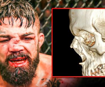 MMA Facts That Will BLOW Your Mind!
