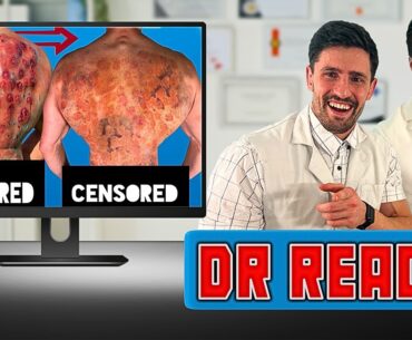 ER Doctor REACTS to my Most PAINFUL Injuries (ft. Doctor ER)