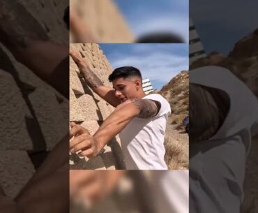 ¿QUÉ LE PASO EN EL BRAZO? 😱