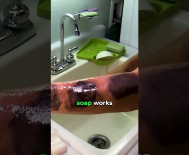 How to never get a serious Poison Ivy Rash again 🌿