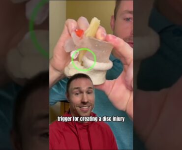 How to Fix a Disc Bulge (WITHOUT SURGERY)