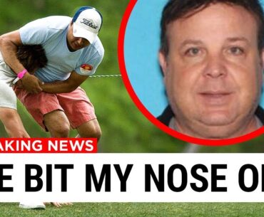 American Golfer BITES Nose Off Competitor.. Here's Why