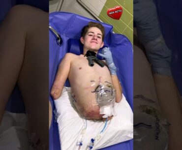 il ne peut plus avoir d'enfants et a été coupé en deux voiçi ce qu'a fait sa copine
