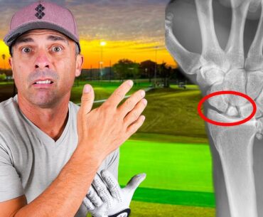 How can I Play Golf in the Good Good Tournament with a Broken Wrist?