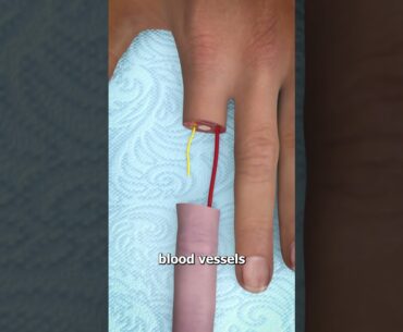 Can You Reattach a Severed Finger? 🤔