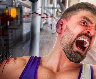 The Worst Injuries You Can Get In The UFC!