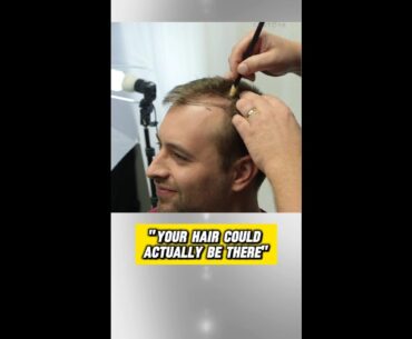 What happens during a hair restortion consultation?