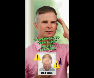 👀 WOW! How did PGA champ Kevin Streelman get his hair back⁉️