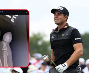 Viktor Hovland suffers a broken toe from a domestic accident