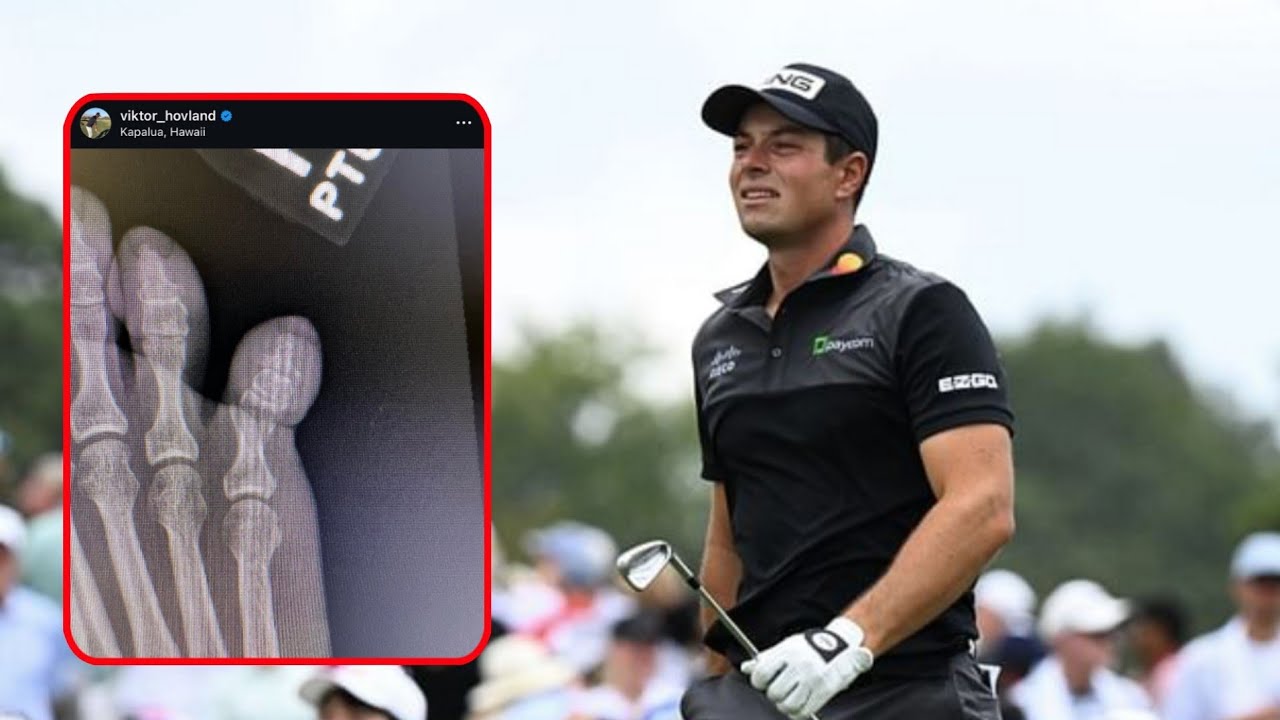 Viktor Hovland suffers a broken toe from a domestic accident Viktor Hovland suffers a broken toe from a domestic accident