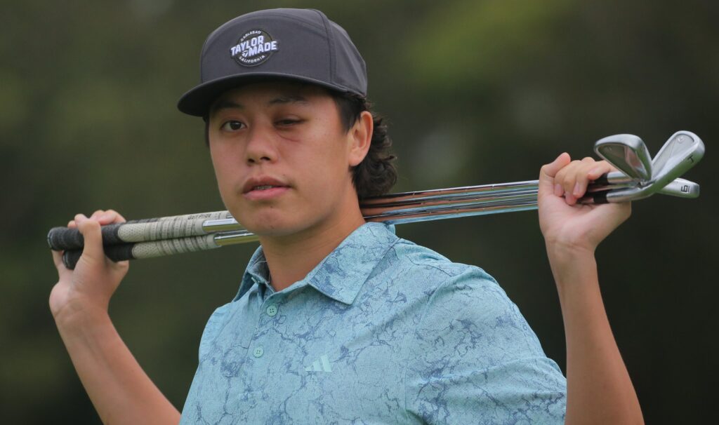 Young star details his eye injury and his determination to return to professional golf