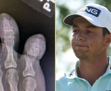 Viktor Hovland's freak bedroom injury leaves golfer wanting to 'cover himself in bubble wrap'