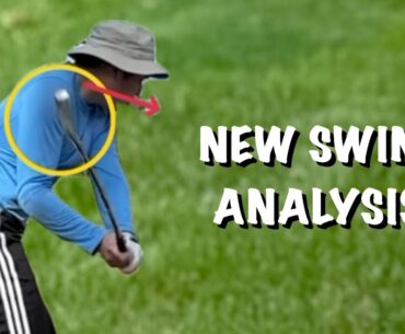 Are you struggling with SHANKS??