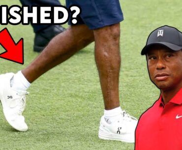 Tiger Woods Ruptures Achilles - Career Over? Doctor Explains