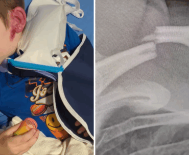 4-year-old boy injured by golf cart at St. Clair Shores Memorial Day parade