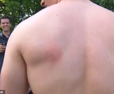 A red welt wasn't the only souvenir a fan took home after being hit by Ben Griffin's tee shot