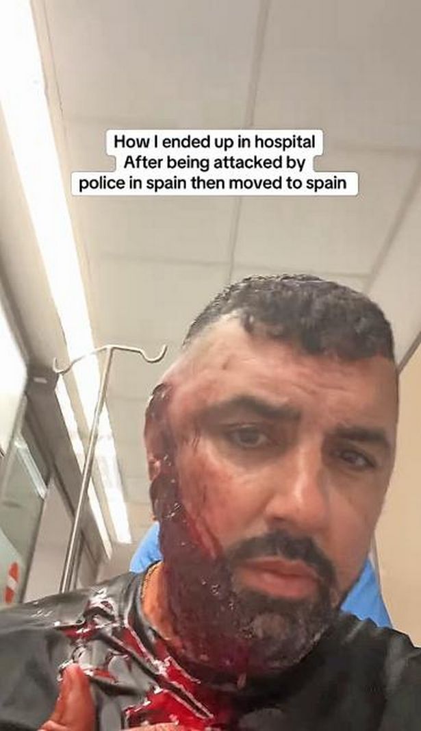 Walker shows off staples in skull and wound