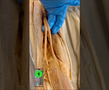 SURPRISING Fix For Tight Hamstrings!😳