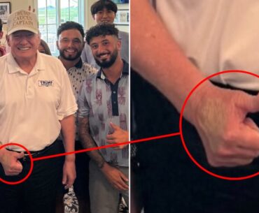 Trump, 79, Soothes Bruised Hand With Surprise Golf Outing