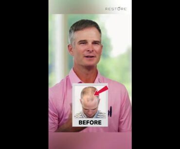 PGA Golfer Kevin Streelman Shares His Restore Hair Story ⛳✨ | FUE Hair Transplant
