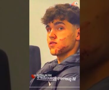 Así le quedó la cara a Pau Cubarsí tras jugar Champions con el Barcelona #futbol #barcelona #shorts