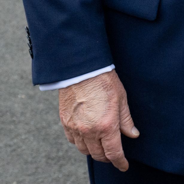 trump hand