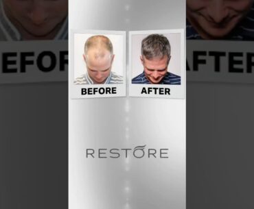 🏌️‍♂️✨ Did Kevin Streelman get a hair transplant?