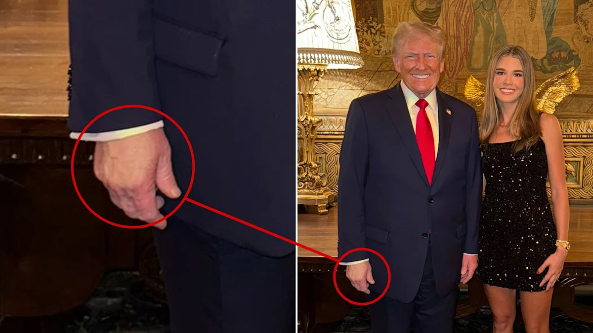 Trump’s Granddaughter Accidentally Reveals How Long He’s Had Hand Issues Yahoo lifestyle home