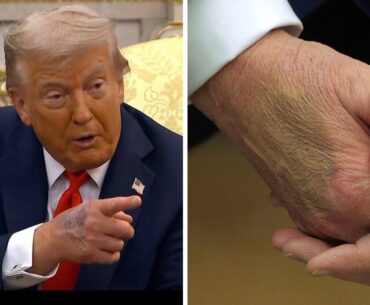 Kai Trump's photos reveal Donald Trump's hand bruise appeared before election- The Week