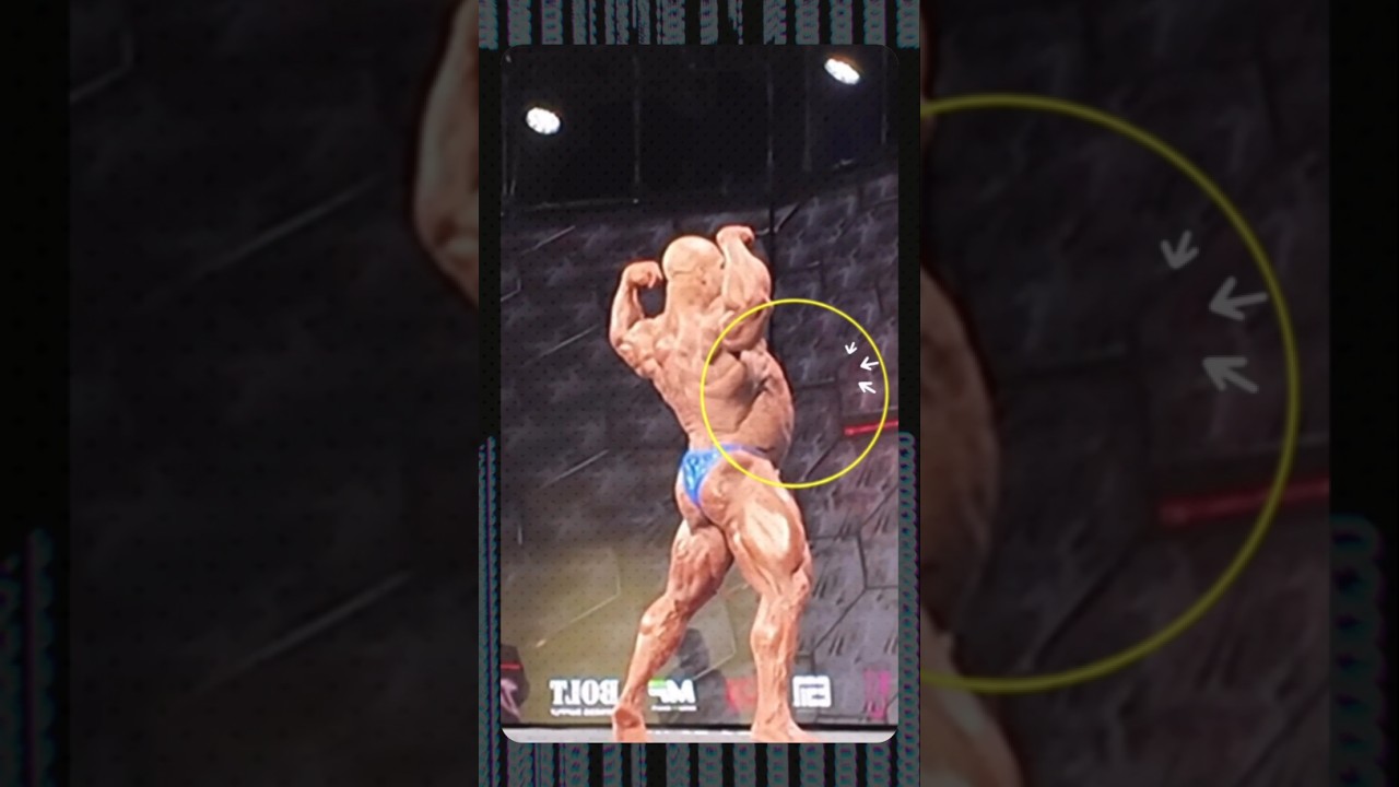 Nick Walker’s Biggest Mr. Olympia 2025 Mistake: Gut Control Controversy & Expert Contest Prep Advice Nick Walker’s Biggest Mr. Olympia 2025 Mistake: Gut Control Controversy & Expert Contest Prep Advice