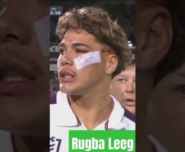 Broncos Reece Walsh sickening collision 🤕 #shorts #nrl #broncos #injury