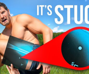 I Got Shot By a Slingshot… And It’s STILL In My Leg