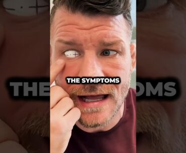 Bisping’s Second Eye Was In Serious Danger 👁️