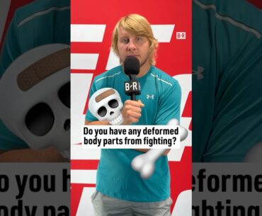 UFC fighters showing off their injuries 🥴