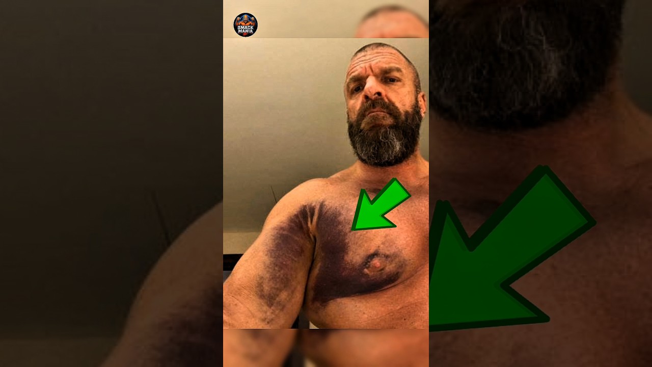 Triple H Injured at Crown Jewel in WWE 😱 #wwe #undertaker #shawnmichaels #wweshorts