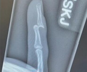 Don’t try and catch a golf ball going 80mph.