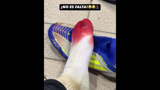 OUCHH 😳😯 Lamine Yamal compartió cómo quedó su pie vs Las Palmas #shorts | ESPN Deportes